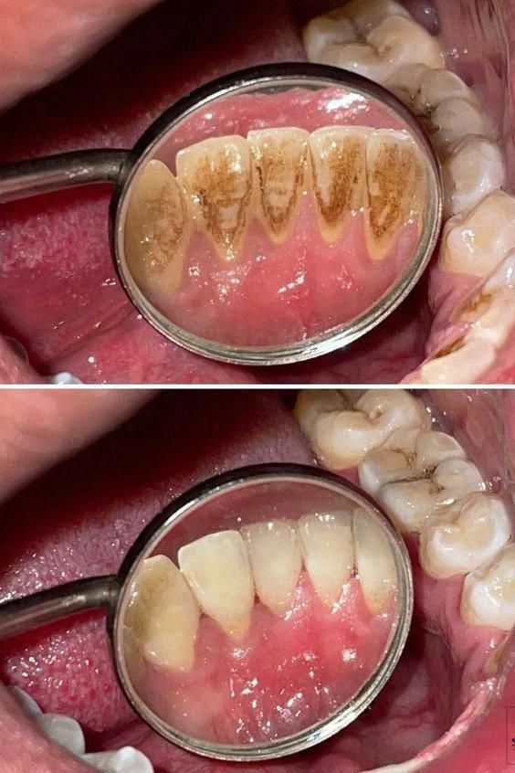 Dr. Geethika's PEARL 32 DENTAL CARE