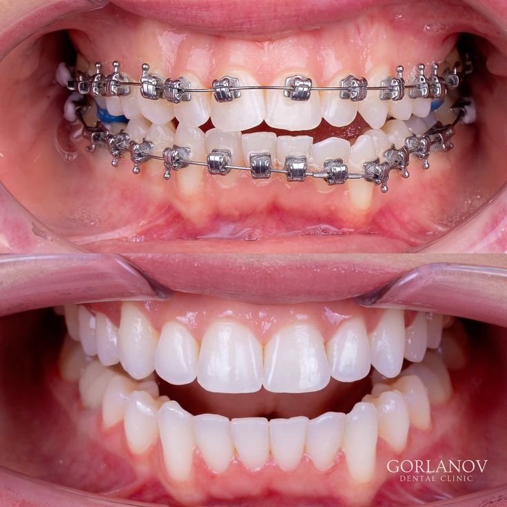 Dr. Geethika's PEARL 32 DENTAL CARE